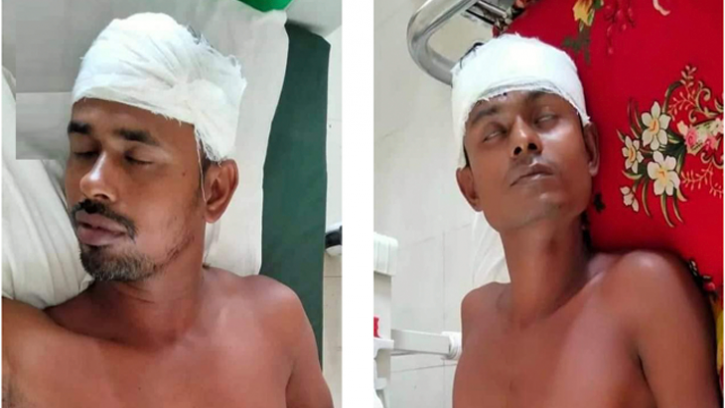 কবুতর নিয়ে ঝগড়ায় দু’সহোদরকে হাতুড়িপেটা