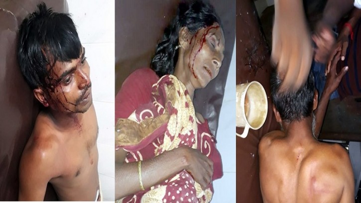 পাইকগাছায় প্রতিপক্ষের হামলায় একই পরিবারের আহত-৩