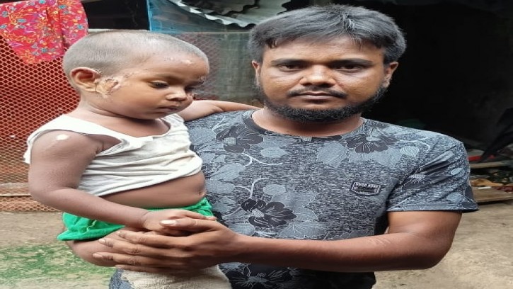 নওগাঁয় সড়ক দুর্ঘটনায় আহত শিশু সাফিউলের চিকিৎসা জুটছে না