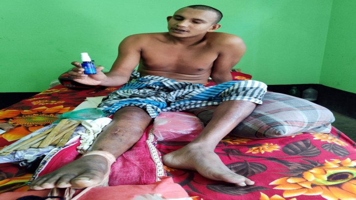 পিরোজপুরে অপ চিকিৎসায় ট্রাকচালক পঙ্গু মামলায় দুই আসামি কারাগারে