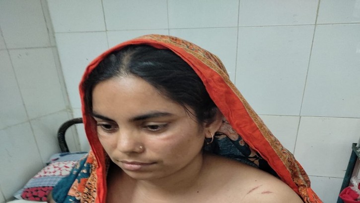 শিবগঞ্জে প্রতিপক্ষের হামলায় গৃহবধু গুরুতর আহত